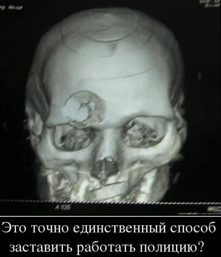 В Питере и Москве полиция начала усердно отлавливать чурбанов.Причины активизации – разные.(Видео)